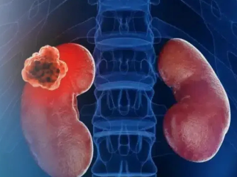 What Makes Cancer Surgery Different From Regular Surgery