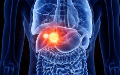 First Symptoms of Liver Cancer in Indians
