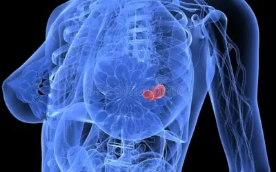 Can Breast Cancer Come Back After Surgery ?