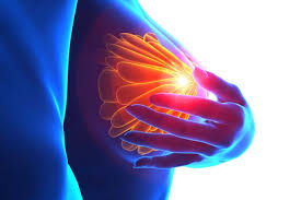 Breast Cancer Surgery Cost in Bangalore 2025