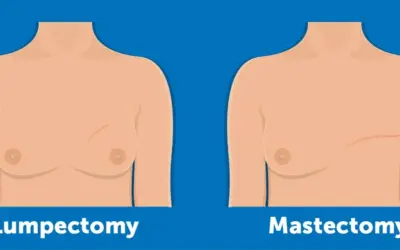 What Is Lumpectomy and How Is It Different From Mastectomy ?