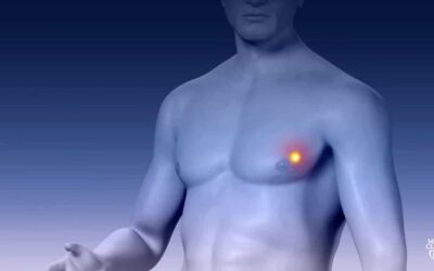 Does Breast Cancer Occur in Men ?