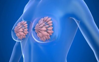 Hormone Therapy vs Surgery in HR Positive Breast Cancer