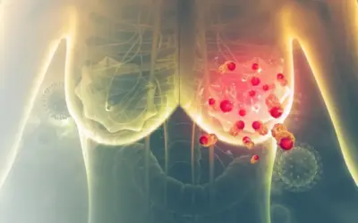 Can I Take HRT After Breast Cancer?