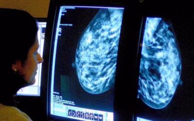 Genetic Testing Before Cancer Surgery?