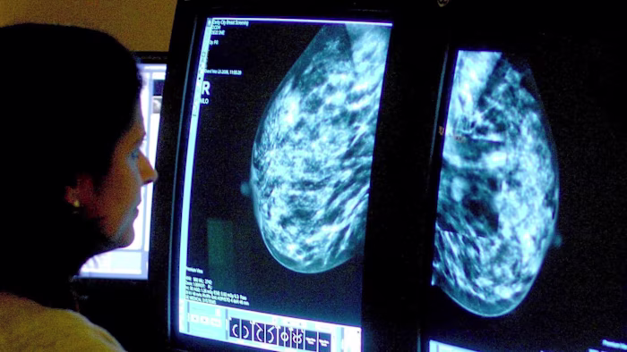 Genetic testing before cancer surgery