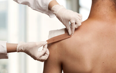 How to Do Home Wound Care After Surgery?