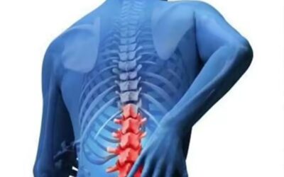 Is Back Pain a Sign of Pancreatic Cancer?