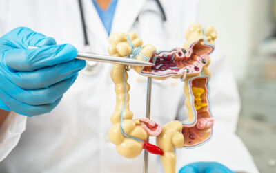 Is Constipation After Cancer Surgery Normal?
