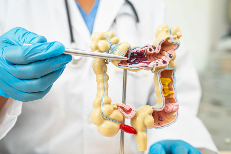 Is constipation after cancer surgery normal