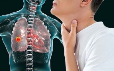 Is Shortness of Breath a Sign of Lung Cancer?