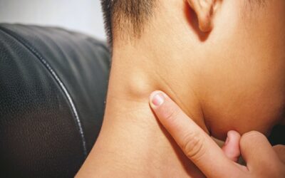 Swollen Lymph Nodes: Cancer or Infection?