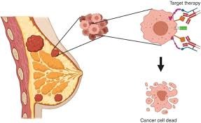 Targeted Therapy vs Chemotherapy: What Is the Difference?