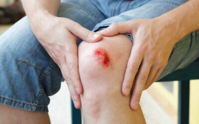 What Does Normal Wound Healing Look Like?
