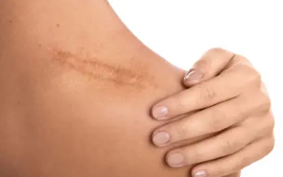 Will I Have Visible Scars After Surgery?