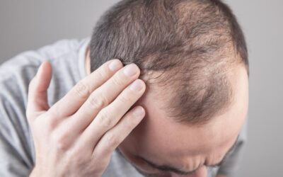 Will I Lose Hair With My Treatment?