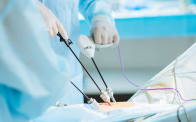 Can Laparoscopy Be Used for Liver Cancer?