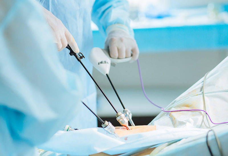 Laparoscopy for Liver Cancer - Dr. Sandeep Nayak