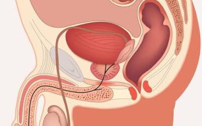 Can Testicular Cancer Recur After Surgery?