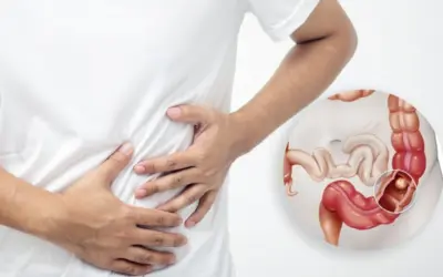 Cost of Rectal Cancer Surgery in Bangalore?