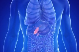 Gallbladder Removal vs Observation: Better?