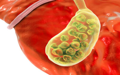 How Is Bile Duct Cancer Detected Early?
