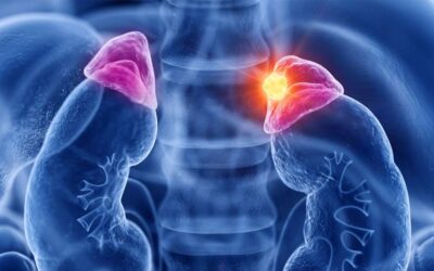 Is Adrenal Cancer Different From Adrenal Tumour?