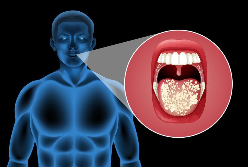 Neck dissection when is it done with oral cancer surgery Dr. Sandeep Nayak