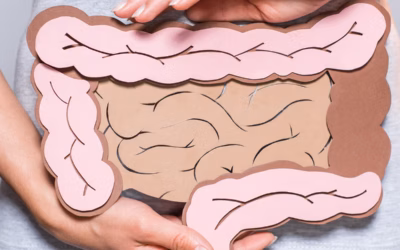 When Is Rectal Cancer Surgery Done Without Radiation?