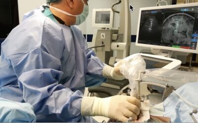 What Is Intraoperative Ultrasound in Surgery?