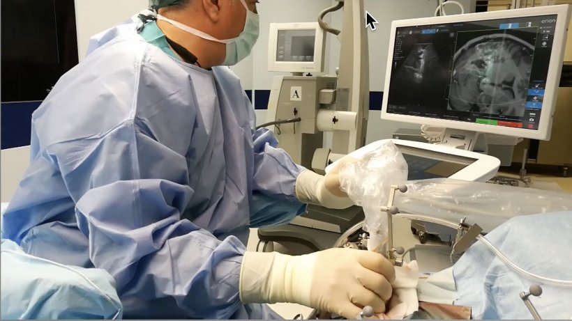 Intraoperative Ultrasound in Surgery - Dr. Sandeep Nayak