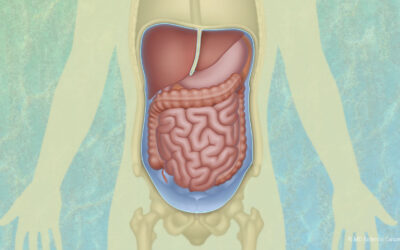 What Is Peritoneal Mesothelioma?