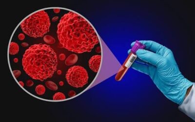 What Is a Liquid Biopsy in Cancer?