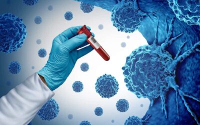 What Is a Multi-Cancer Early Detection Test?