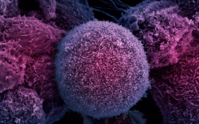 Can Prostate Cancer Grow Slowly Without Symptoms?