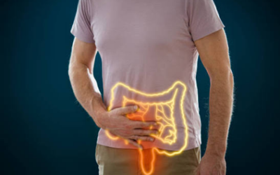 Stage 0 to Stage 4 Colon Cancer: A Complete Patient Guide