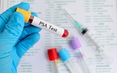 What Is PSA Test and When Should Men Get It?