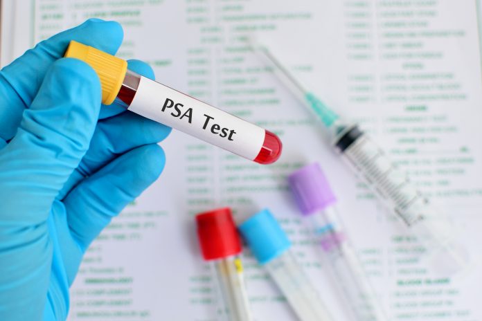 What Is PSA Test and When Should Men Get It?