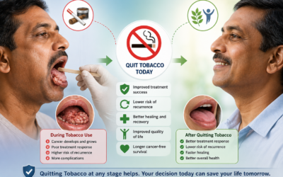 Does Quitting Tobacco Help After Oral Cancer?