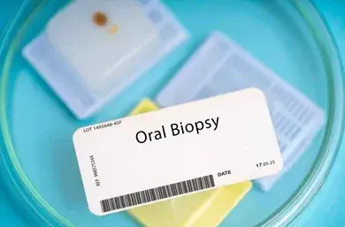 Oral cancer Label reading 'Oral Biopsy' on a specimen card with a barcode, resting atop sealed containers in a blue dish.