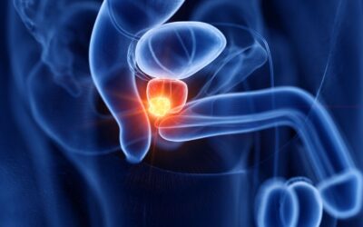 Can Prostate Cancer Be Cured Without Surgery?