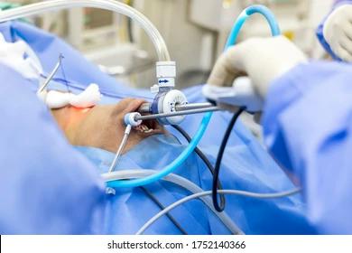 robotic thyroid surgery