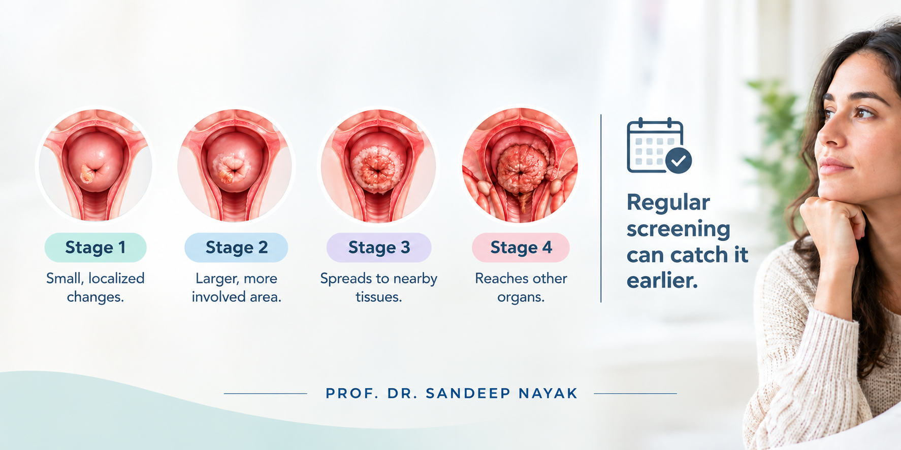 progression stages 1–4 of cervical cancer showing localized to widespread changes and the message that regular screening helps early detection.