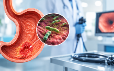 Does H. Pylori Infection Cause Stomach Cancer?