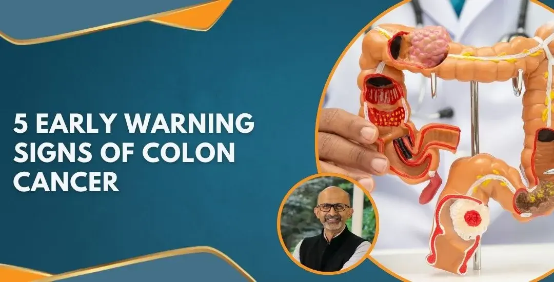 Informational banner about 5 early warning signs of colon cancer, with a doctor’s portrait and a 3D colon model on the right.