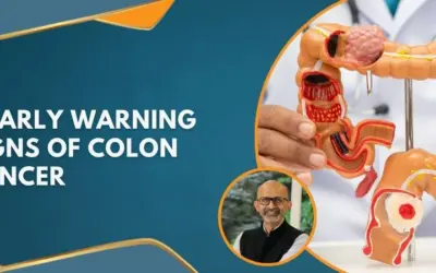 5 Early Warning Signs of Colon Cancer You Should Never Ignore