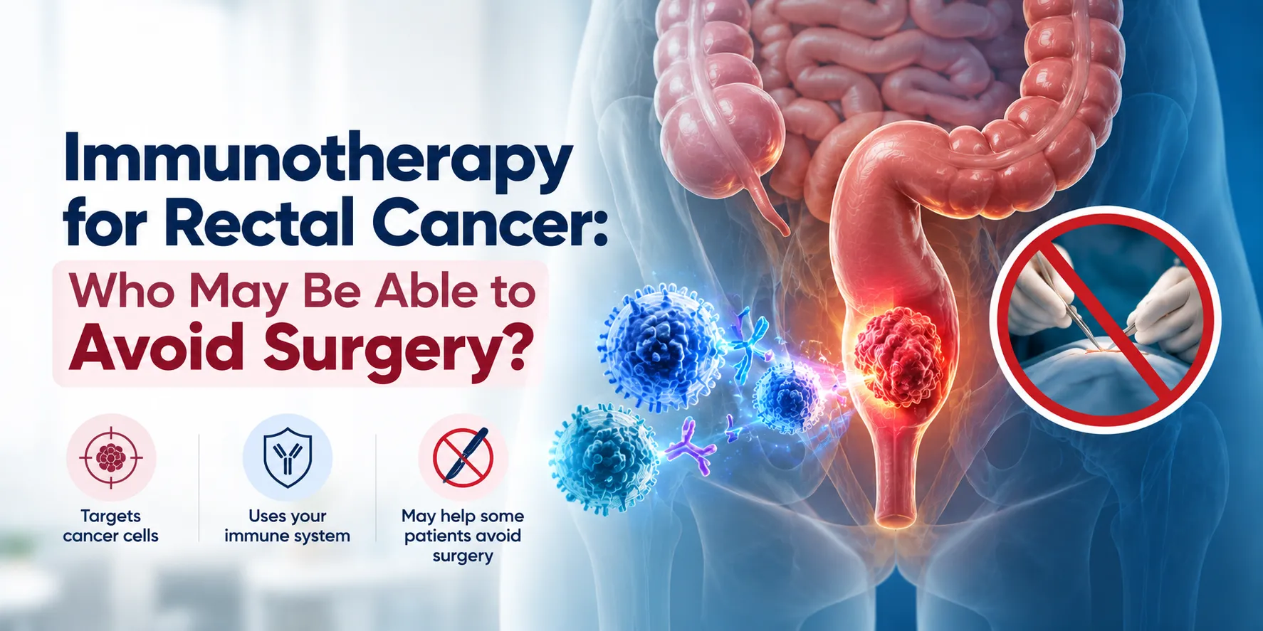 banner explaining immunotherapy for rectal cancer and the potential to avoid surgery